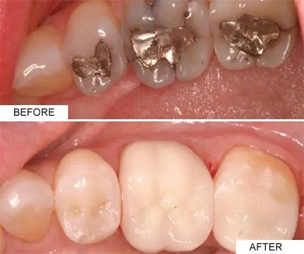 Dental Clinic in Jaipur