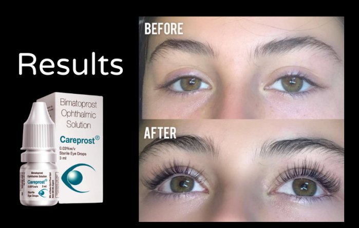 Careprost Eyelash Serum