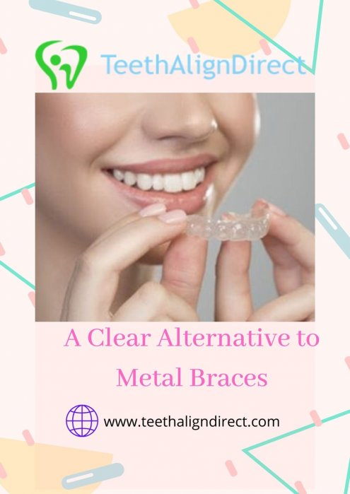 Get Online Invisible Aligners in Santa FE-TeethAlignDirect