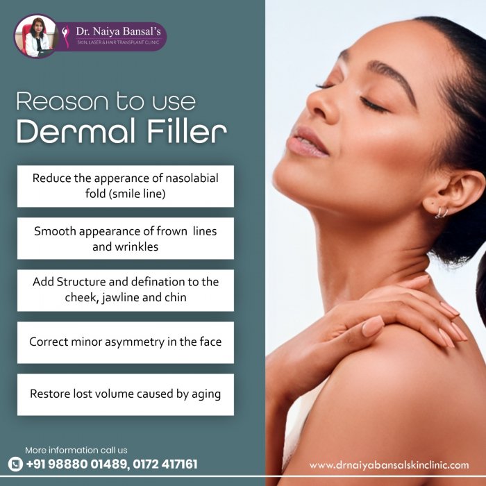 Dr Naiya Bansal - Dermal Fillers Treatment in Chandigarh