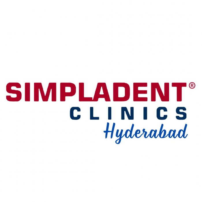 Full Mouth Dental Implant in Hyderabad