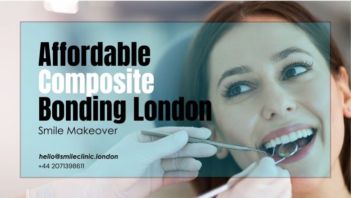 Affordable Composite Bonding London | Smile Makeover