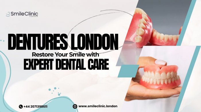 Dentures London – Restore Your Smile with Expert Dental Care