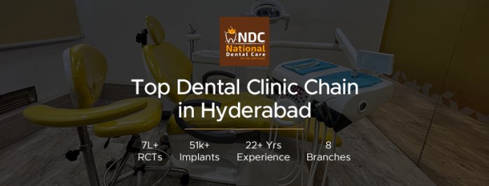 National Dental Care - Best Dental Clinic in Vanasthalipuram